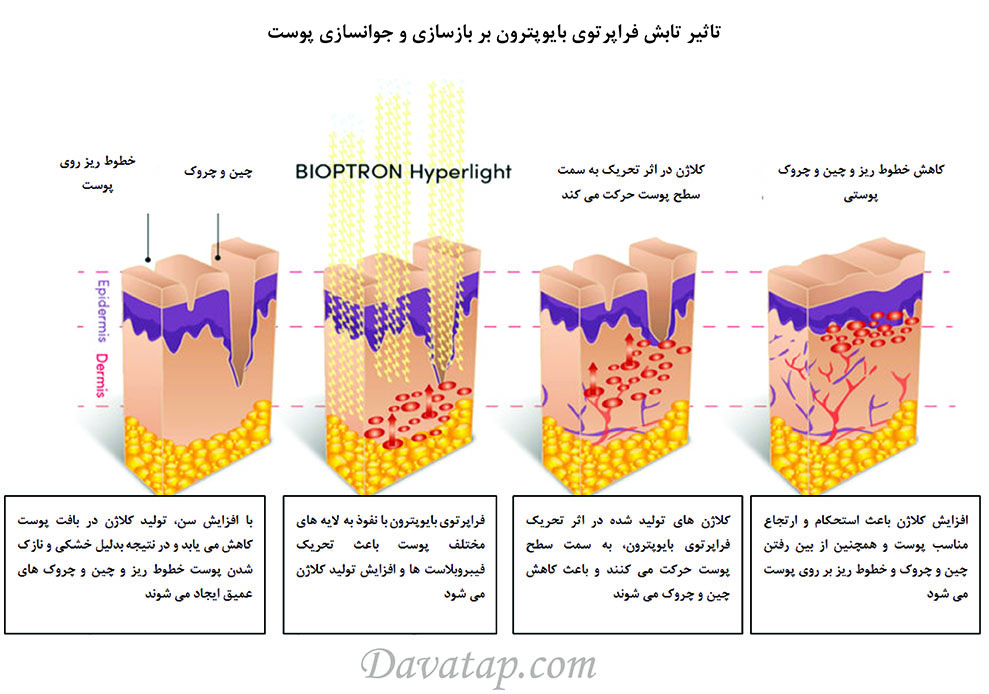 تاثیر تابش بر جوانسازی پوست