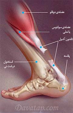 تاندون آشیل