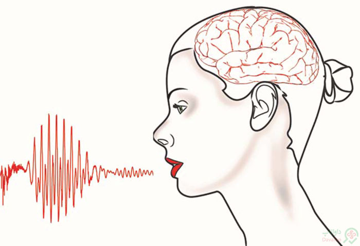 مشکل در گفتار